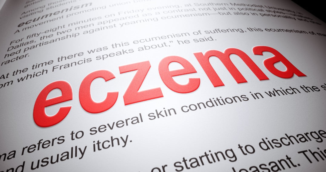 Clearing the Way to Healthy Skin: Natural and Effective Eczema Treatment
