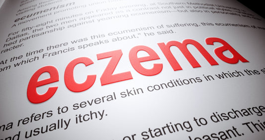 Clearing the Way to Healthy Skin: Natural and Effective Eczema Treatment