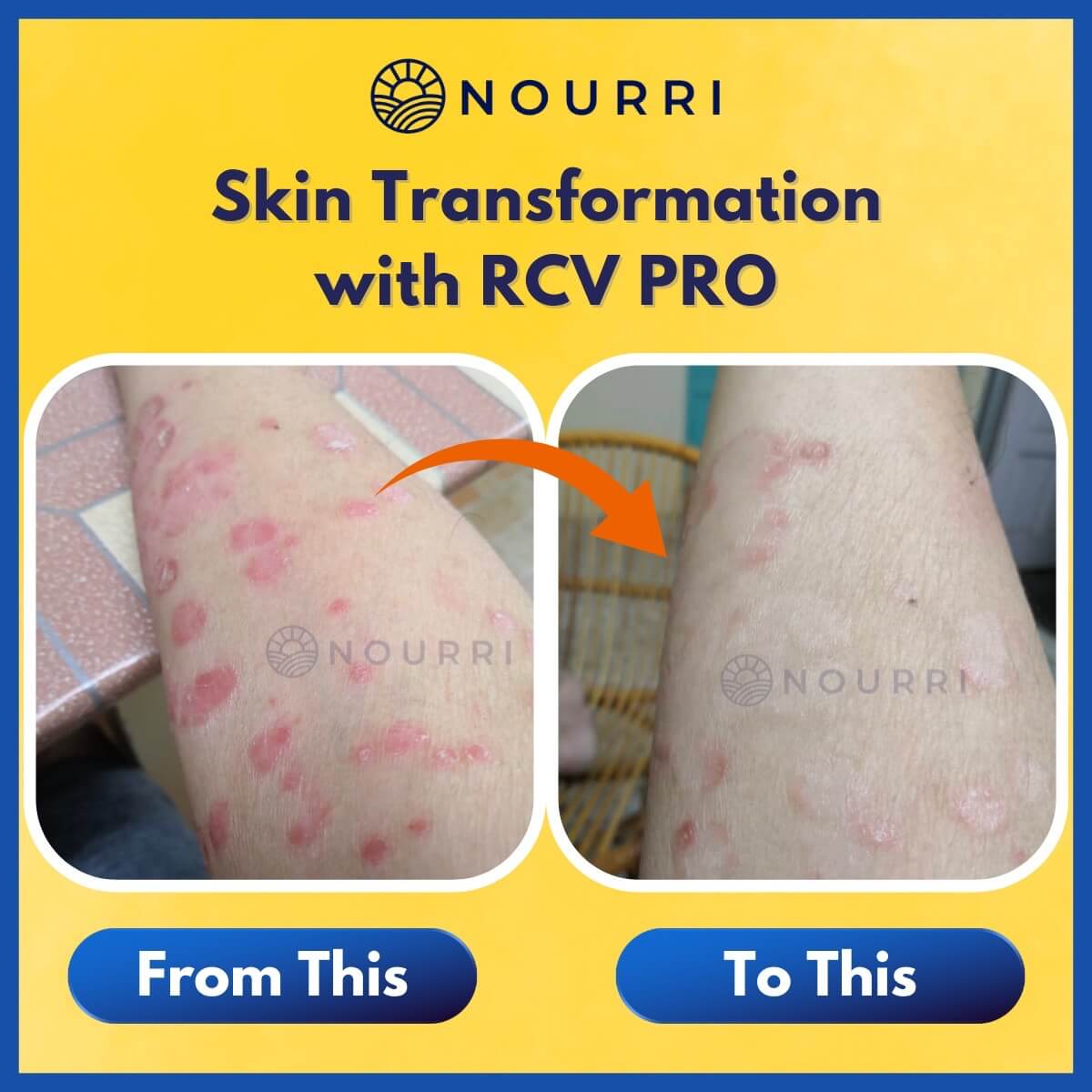 RCV PRO - Elevating Skin Resilience – NOURRI